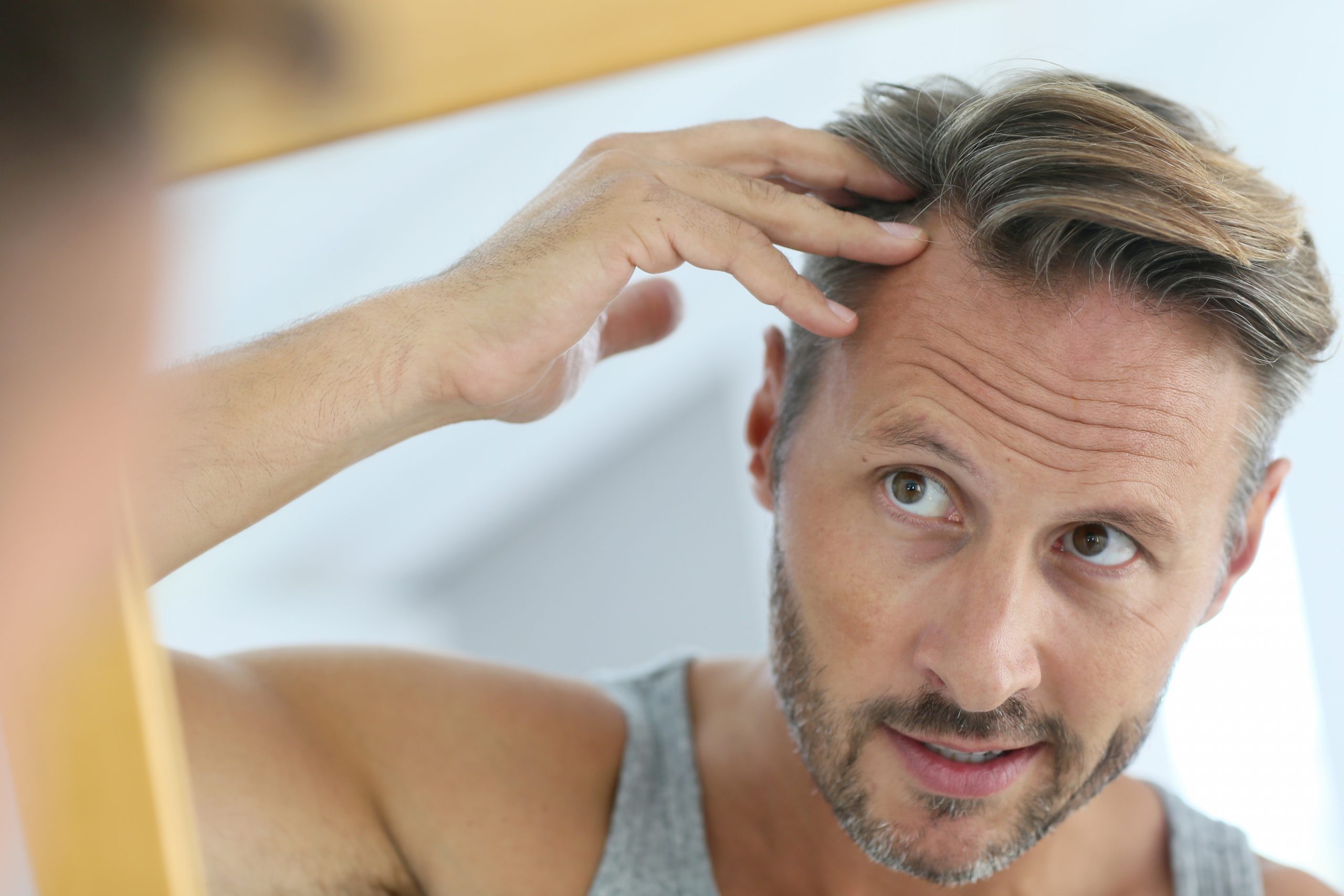 Why is My Hair Falling Out? - Healthcare Associates of Texas