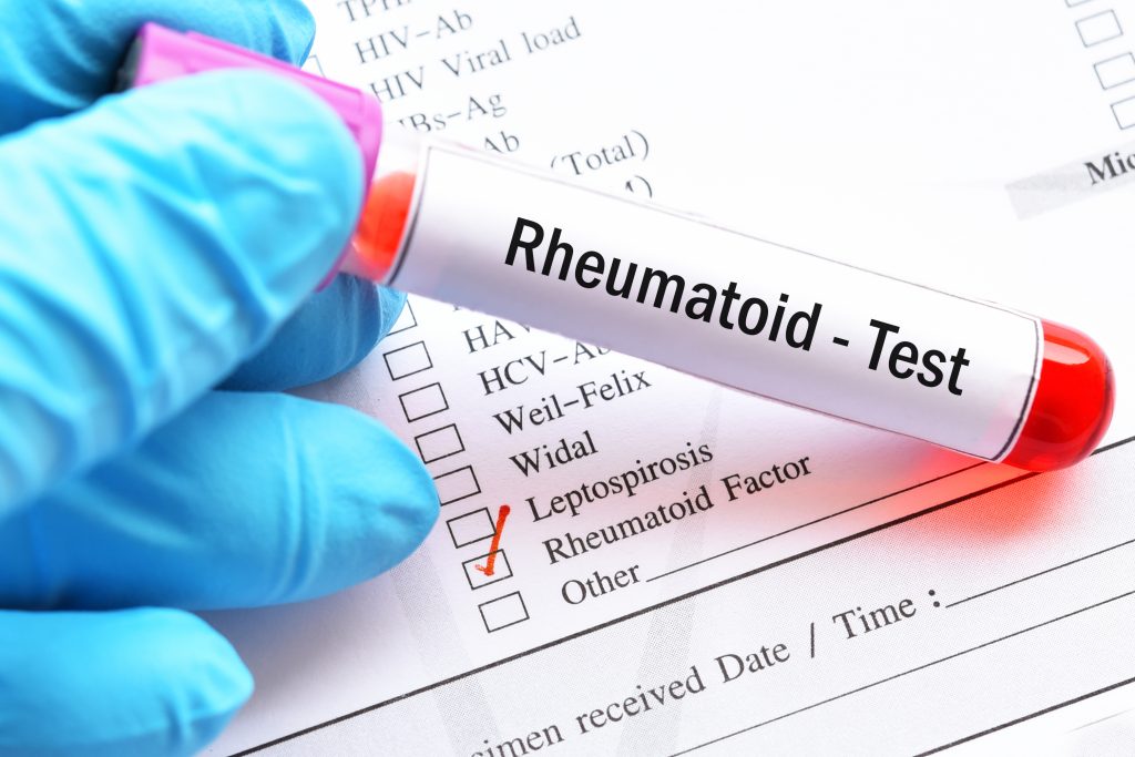 rheumatoid arthritis test