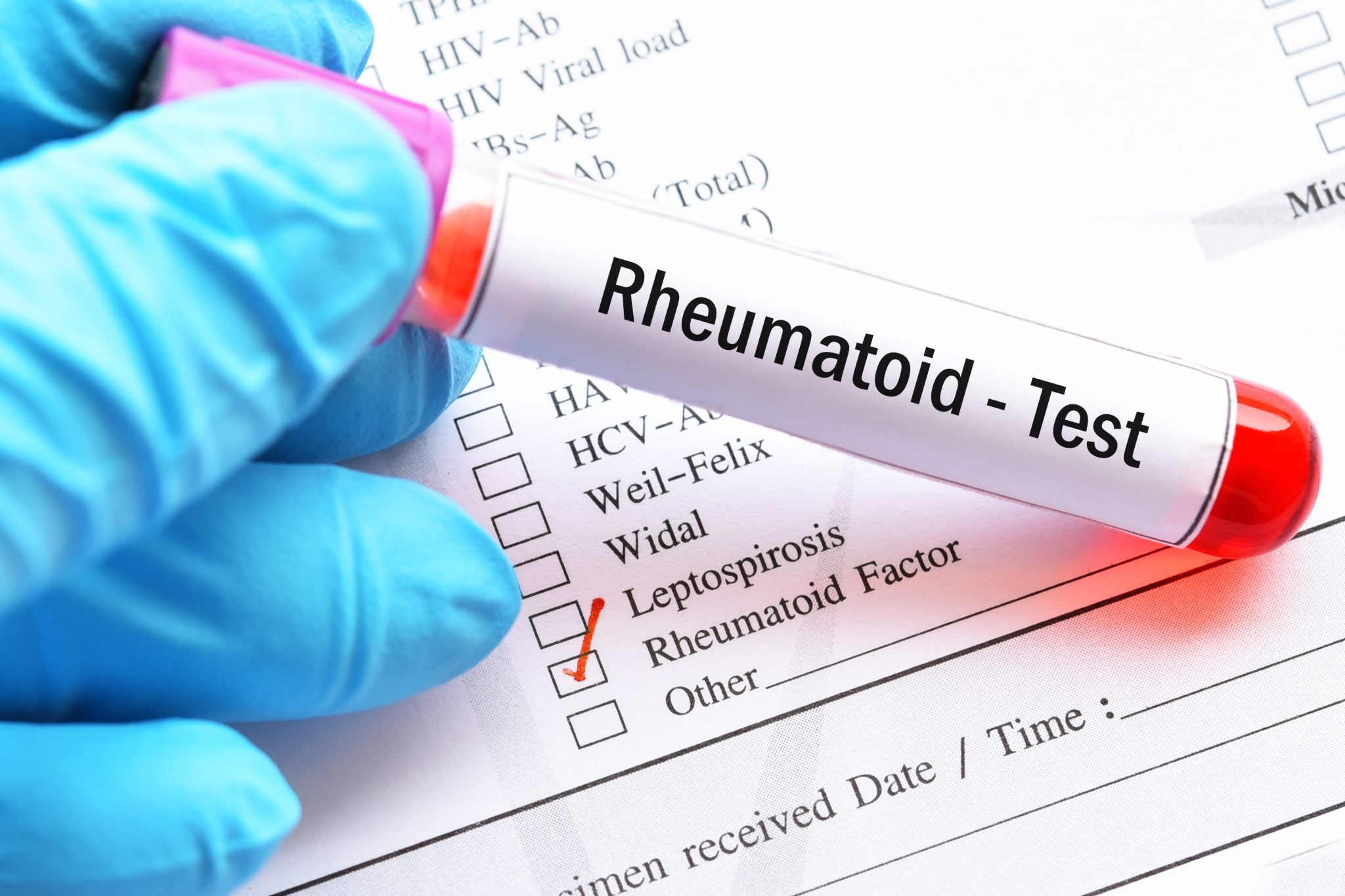 How to Treat Rheumatoid Arthritis Healthcare Associates of Texas