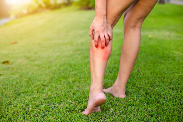 Why Do My Legs Itch When I Walk? Healthcare Associates of Texas